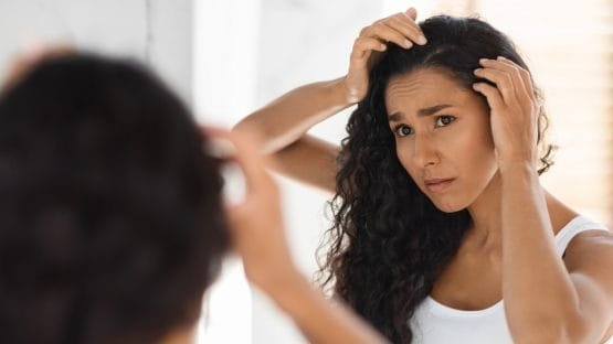 How Ayurveda Can Help You Get Rid of Dandruff Naturally